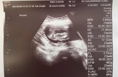 แม่ๆว่า ลูกสาว หรือ ลูกชาย ค่ะ แม่แอบลุ้นมากกก คนโต ผู้ชาย ท้องนี้ ลุ้นลูกสาวเลยค่ะ😍