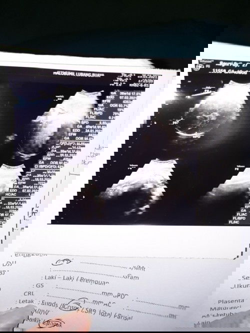 HPL 27 januari 2021 + 3 hari waktu tunggu