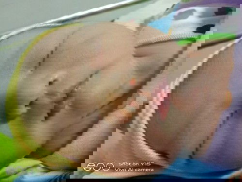 Lahir 4 hari sebelum HPL tapi harus dengan SC