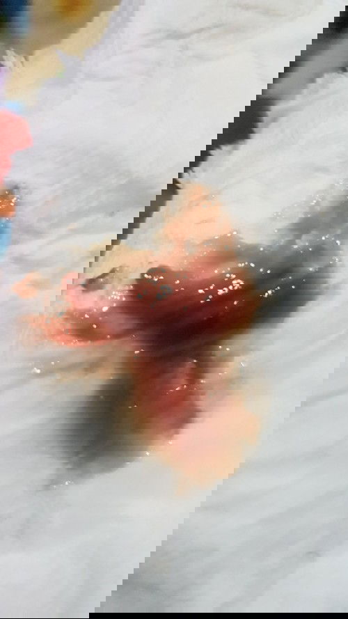 เมื่อวานหลังจากโดนกระตุ้นปากมดลูกมา