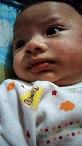 Pipi merah
