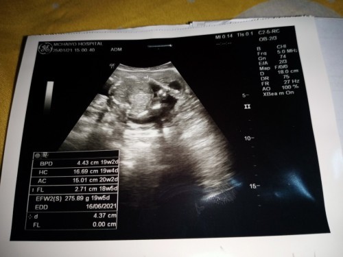 20w แม่ๆบ้านไหนดูเห็นไหมค่ะ
ว่าผู้หญิงหรือผู้ชาย?👦👧
เราดูไม่เป็นหมอก้อไม่ได้บอก