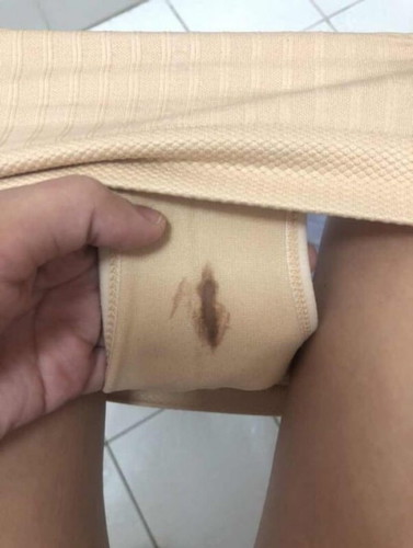 เลือดหรือ อะไร?