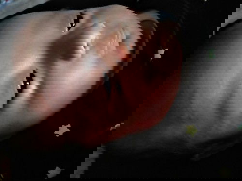 Merah-merah pada bayi