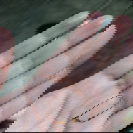 Avout cesarian section