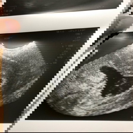 สอบถามผู้รู้หน่อยค่ะ