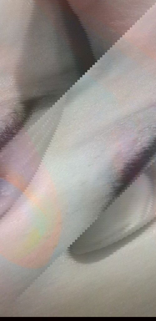 I am having a problem with my 5yrs old boy he got some skin issues.