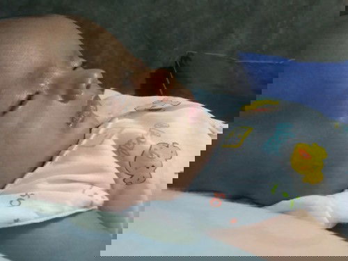 Warna kulit gak merata?