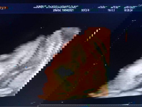 ท้องแรกกกก ขอบคุณล่วงหน้าค่ะ