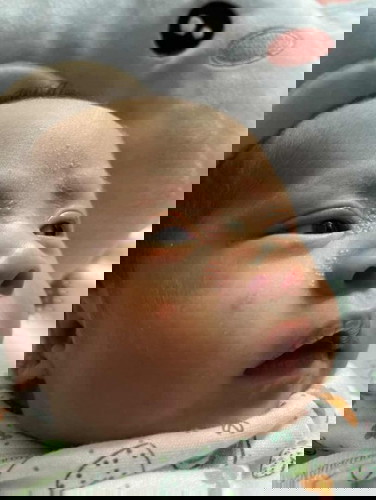 แม่ๆช่วยหน่อยคะ แบบนี้คือลูกแพ้อะไร หรือผื่นทารกธรรมดาหรอคะ