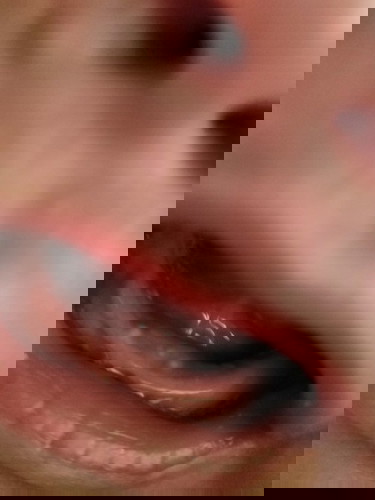 White spots sa gums ni baby?