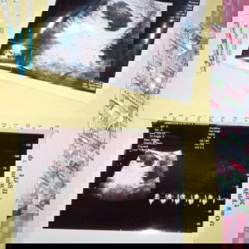 Worry hamil paska kuret