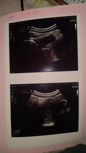 ขอสอบถามแม่ๆผู้มีประสบการณ์หน่อยคะ