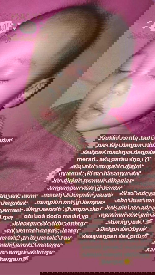 Kelopak mata bayik bengkak !!