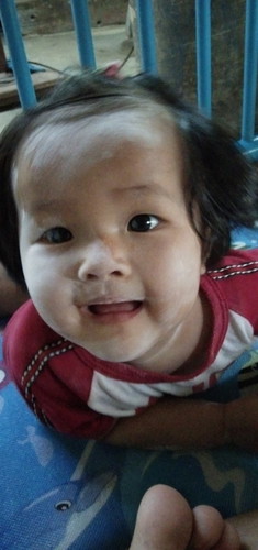 ฟันน้องไม่ขึ้น