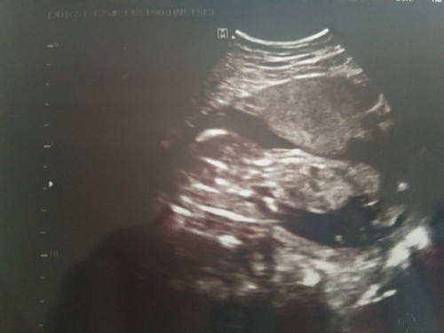 ลุ้นเพศต่อไปจ้าาา