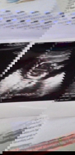 Bulan lalu saya USG usia kandungan saya 5 bulan kata dokter jenis kelaminnya laki2 .ap itu pst?