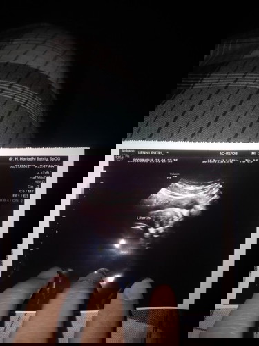 bund tadi aku dtg usg dan dokternya blg blum ada janinnya normal kah rahimnya ukurannya segitu?