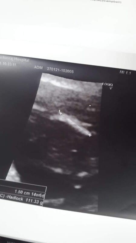 หมอบอกได้ผ.ชจ้ะ