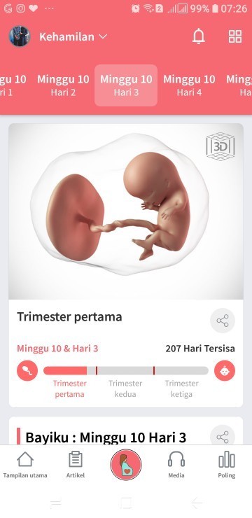 Ada yang tau ga bun
