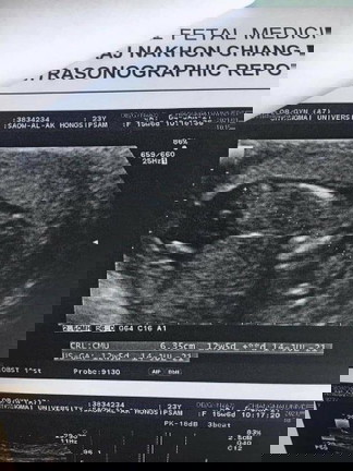 3เดือน ทายกันหน่อยว่า ช 👶หรือ ญ👩