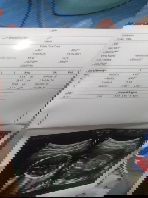 แม่ๆว่าน้องเพศอะไรคะ แม่ดูไม่ค่อยเป็นเท่าไร แม่รุ่นลูกสาว แต่ว่าน้องเป็นผู้ชาย