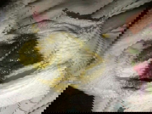 ผิดปกติใหมคะ