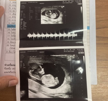 ช่วยเดาเพศให้หน่อยค่ะ