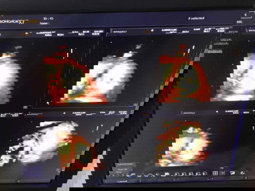 แม่ๆทีมมีนา 64