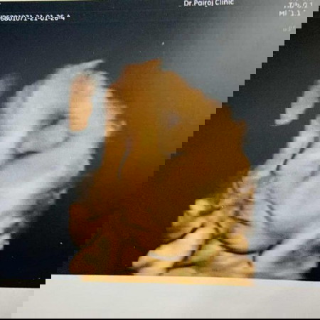 ขอดูเด็กเดือนกุมภาพันธ์หน่อยค่า#ลูกสาว#ลูกคนแรก