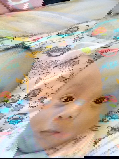 Bercak putih seperti panu