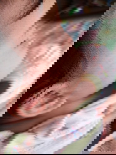 ส่าไข้เป็นแบบไหน