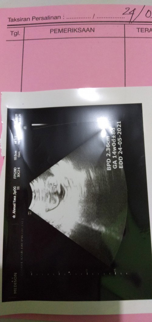 Saya hamil anak ke dua dan berharap tuhan kasih saya anak perempuan.. semoga terkabul aamiin