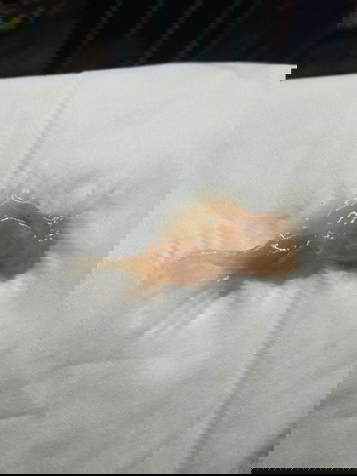 ถ้ามีแบบนี้ต้องไปโรงบาลเลยไหมค่ะ