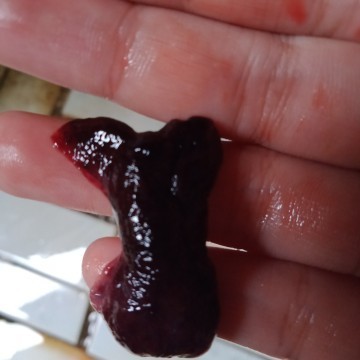 6th week pregnant