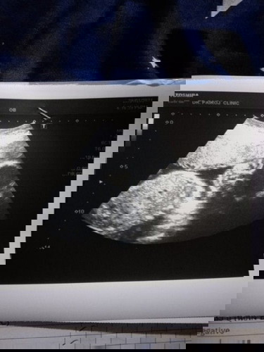 บ้านนี้ 27w4d น้ำหนักลูก1055กรัม
บ้านอื่นน้ำหนักลูกได้เท่าไหร่กันค่ะ