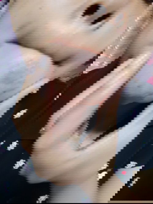 NATURAL LANG PO BA NA MARAMING TUTUBONG PIMPLES SA PAGBUBUNTIS NIYO? 

#6WEEKS AND 2 DAYS
# PREGNANT