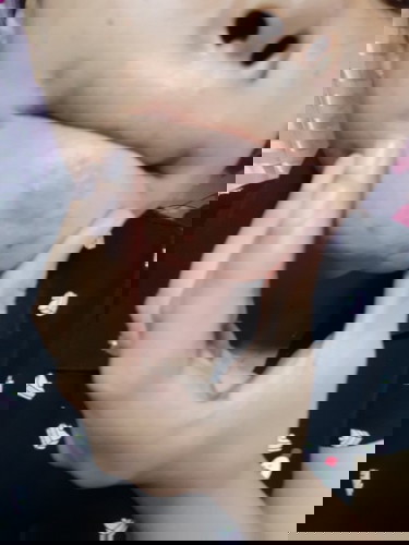 NATURAL LANG PO BA NA MARAMING TUTUBONG PIMPLES SA PAGBUBUNTIS NIYO?
#6WEEKS AND 2 DAYS
# PREGNANT