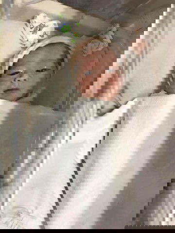 หน้าเปลี่ยน...สีผิวเปลี่ยน🤩🤩👶