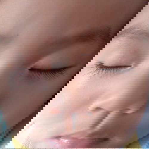 bintik2 putih di kelopak mata