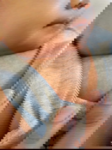 meron po bang same case ganito sa baby ko?white spots sa katawan po.normal lang po b?kusa ba mawwla?