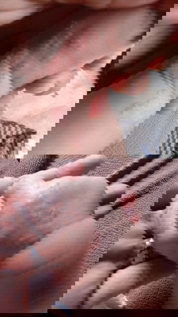 Bruntusan ditangan dan kaki