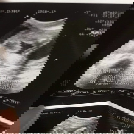 แบบนี้น่าจะ ญ หรือ ช น้อ