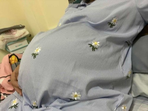 🤰🏻แม่ๆที่ท้องแฝดส่วนมากคลอดกี่สัปดาห์คะ