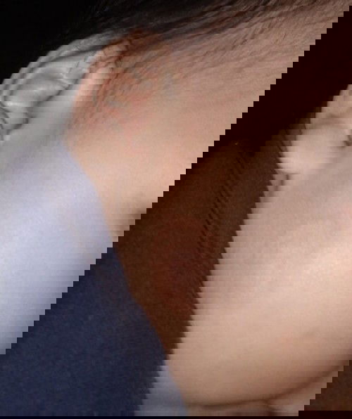 DI MALAMAN KUNG ANO NASA PISNGI