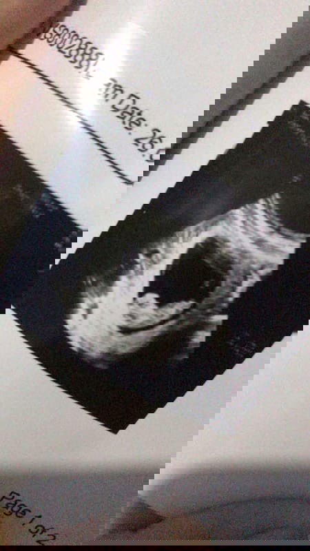 Cara mengatasi sakit ulu hati gimana ya bun?