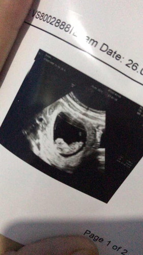 Cara mengatasi sakit ulu hati gimana ya bun?