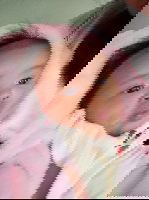 สอบถามแม่ๆค่ะ น้องเป็นผื่นแดง