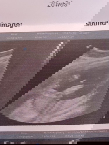 นอนไม่อายฟ้าอายดินเลยน่ะลูก