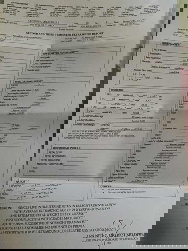 Iikot pa kaya si baby breech 7months